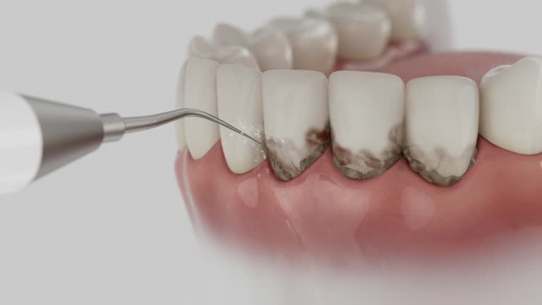 Reliable Dental contractor in Kosciusko, MS by Dentist Open Now